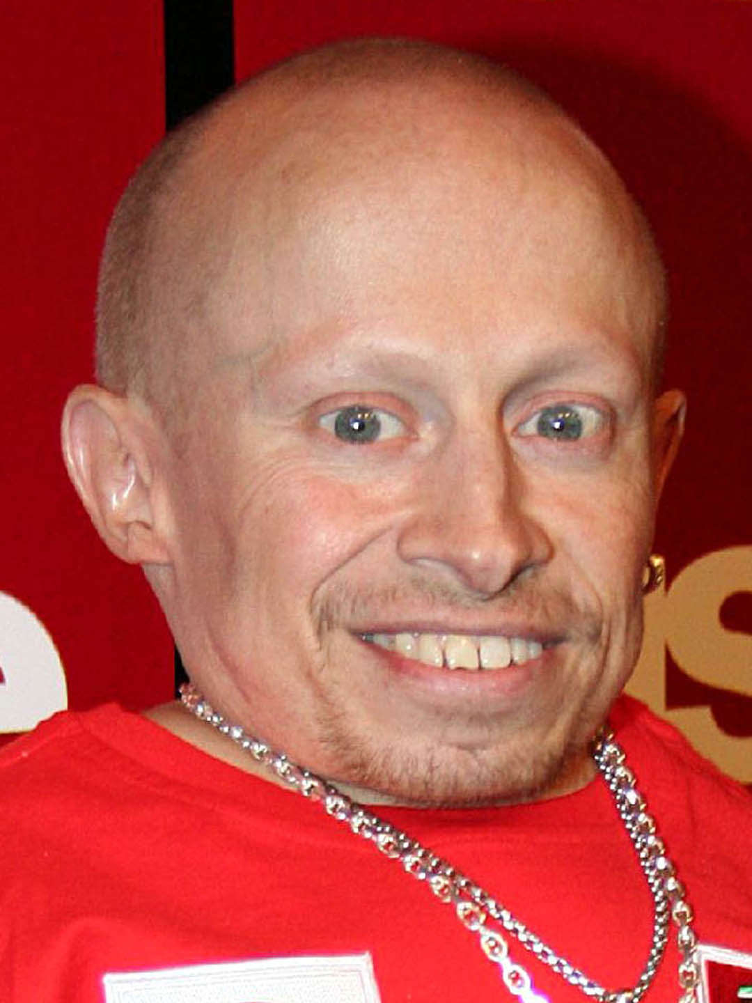 Verne Troyer