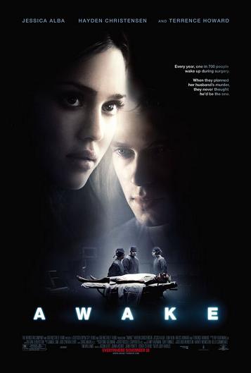 Awake - Anestesia cosciente