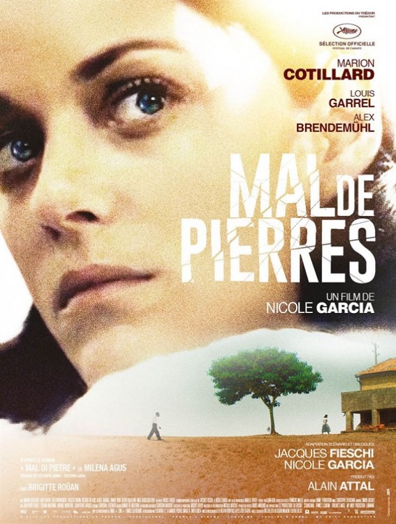 Mal di pietre