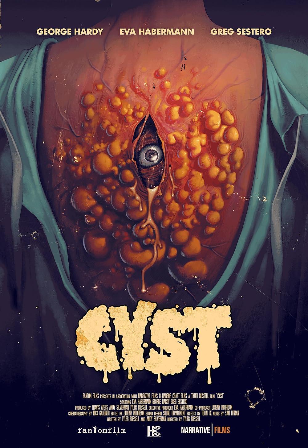 Cyst - La ciste assassina